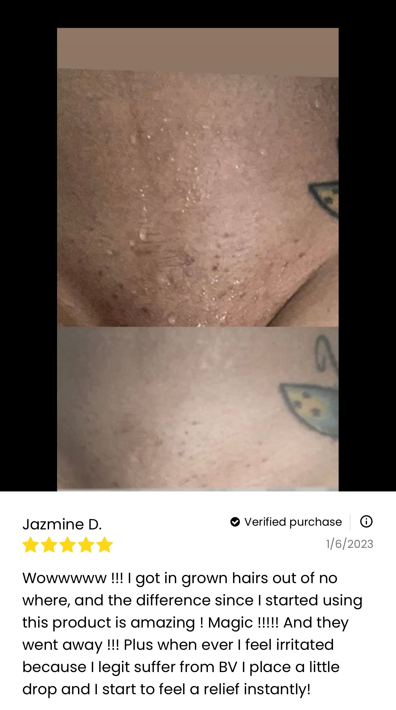 Her Fantasy Box Renew Her Yoni Oil - For Dryness, Ingrown Hair, Dark Marks & Scars