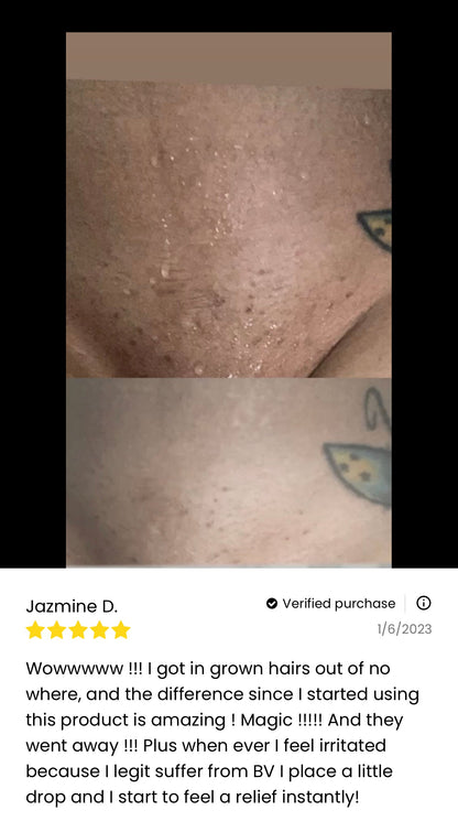 Her Fantasy Box Renew Her Yoni Oil - For Dryness, Ingrown Hair, Dark Marks & Scars